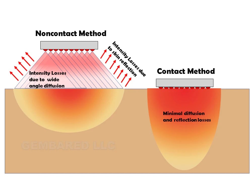 Contact vs NonContact red light Gembared