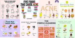 diet acne infographics