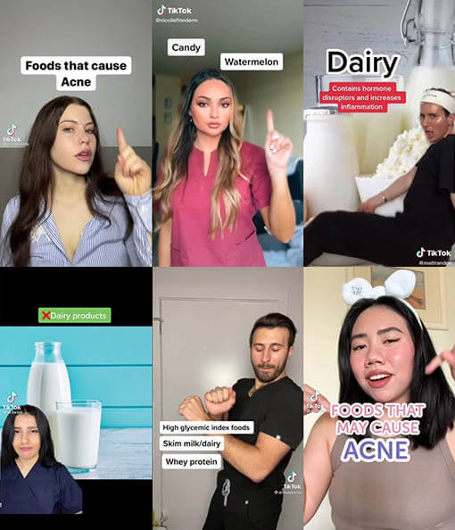 diet acne tiktok