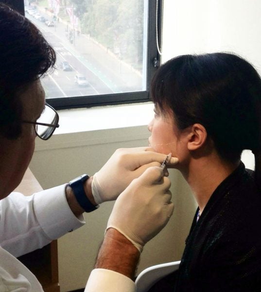 My Masseter Reduction Experience