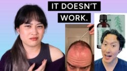 rosemary oil hair loss