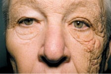 Why you should protect your skin from UVA (and how)