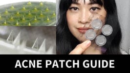 Guide to Acne Patches: Hydrocolloid, Treatment, Microneedle (Video)